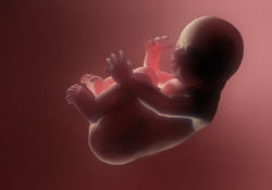 foetus, spina bifida, opération, enceinte