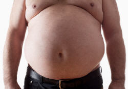 obésité, surpoids, gène, génétique