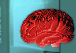 cerveau, op�ration, magazine, reportage