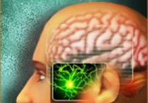 Confusion mentale